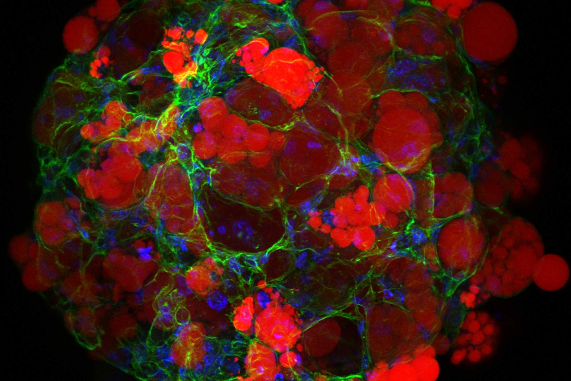 Three-dimensional (3D) adipose tissue organoids for disease modeling. Lipid (red), actin (green), nucleus (blue).