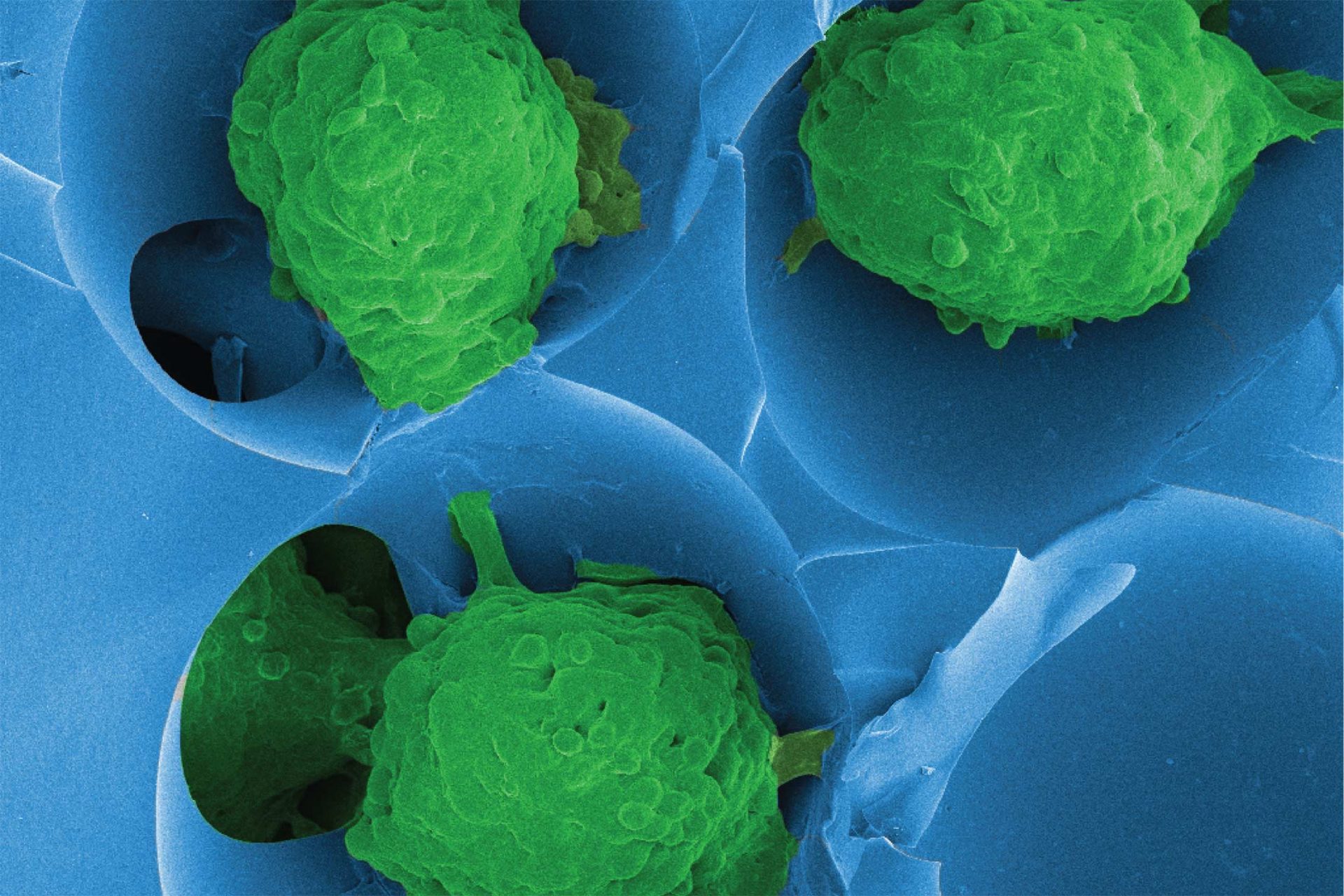 Cell in an engineered scaffold