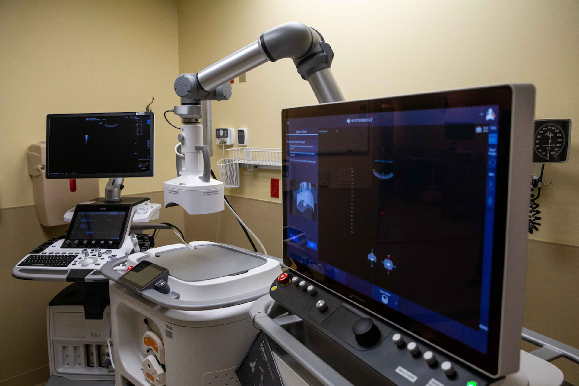 Technology used to perform histotripsy, a revolutionary non-invasive cancer treatment recently made available for the first time in West Michigan, at the University of Michigan Health-West Professional Building in Wyoming
