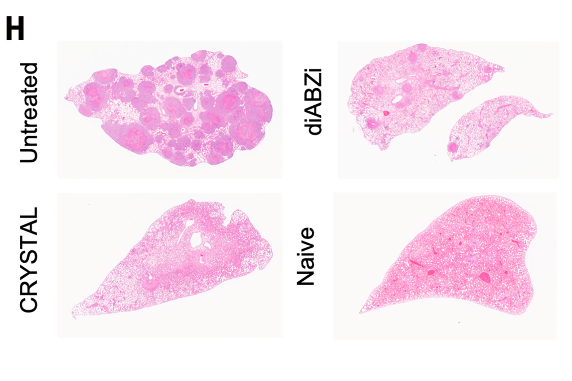 Representative H&E-stained lung tissues and quantification of tumor burden (% tumor area per lung section).