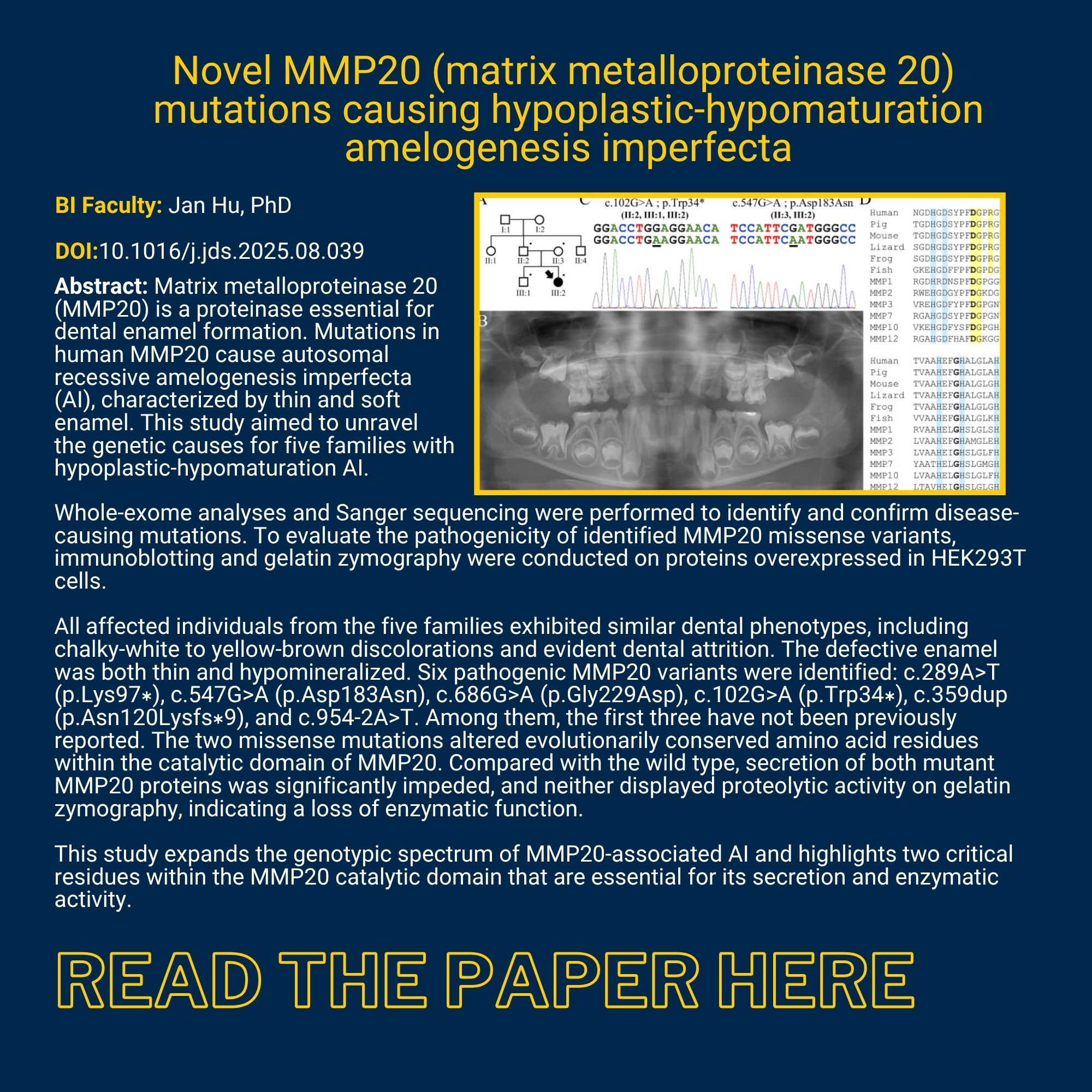 Novel MMP20 (matrix metalloproteinase 20) mutations causing hypoplastic-hypomaturation amelogenesis imperfecta BI Faculty: Jan Hu, PhD DOI:10.1016/j.jds.2025.08.039 bstract: Matrix metalloproteinase 20 (MMP20) is a proteinase essential for dental enamel formation. Mutations in human MMP20 cause autosomal recessive amelogenesis imperfecta (AI), characterized by thin and soft enamel. This study aimed to unravel the genetic causes for five families with hypoplastic-hypomaturation AI. Whole-exome analyses and Sanger sequencing were performed to identify and confirm disease-causing mutations. To evaluate the pathogenicity of identified MMP20 missense variants, immunoblotting and gelatin zymography were conducted on proteins overexpressed in HEK293T cells. All affected individuals from the five families exhibited similar dental phenotypes, including chalky-white to yellow-brown discolorations and evident dental attrition. The defective enamel was both thin and hypomineralized. Six pathogenic MMP20 variants were identified: c.289A>T (p.Lys97∗), c.547G>A (p.Asp183Asn), c.686G>A (p.Gly229Asp), c.102G>A (p.Trp34∗), c.359dup (p.Asn120Lysfs∗9), and c.954-2A>T. Among them, the first three have not been previously reported. The two missense mutations altered evolutionarily conserved amino acid residues within the catalytic domain of MMP20. Compared with the wild type, secretion of both mutant MMP20 proteins was significantly impeded, and neither displayed proteolytic activity on gelatin zymography, indicating a loss of enzymatic function. This study expands the genotypic spectrum of MMP20-associated AI and highlights two critical residues within the MMP20 catalytic domain that are essential for its secretion and enzymatic activity. 